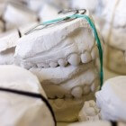 Ixorg biedt alternatief voor tandartsverzekering
