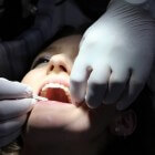 Een goedkope tandarts vinden: hoe pak je het aan?