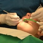 Orthodontie verzekeren voor kinderen tot 18 jaar